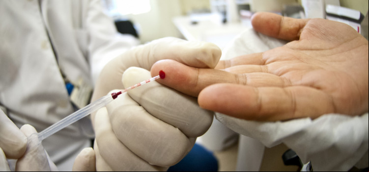 Taxa de detecção de AIDS cresce no Brasil